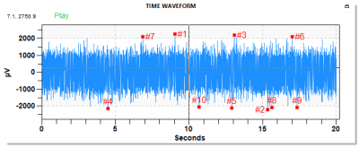 SDT Ultranalysis Suite 3 time waveform